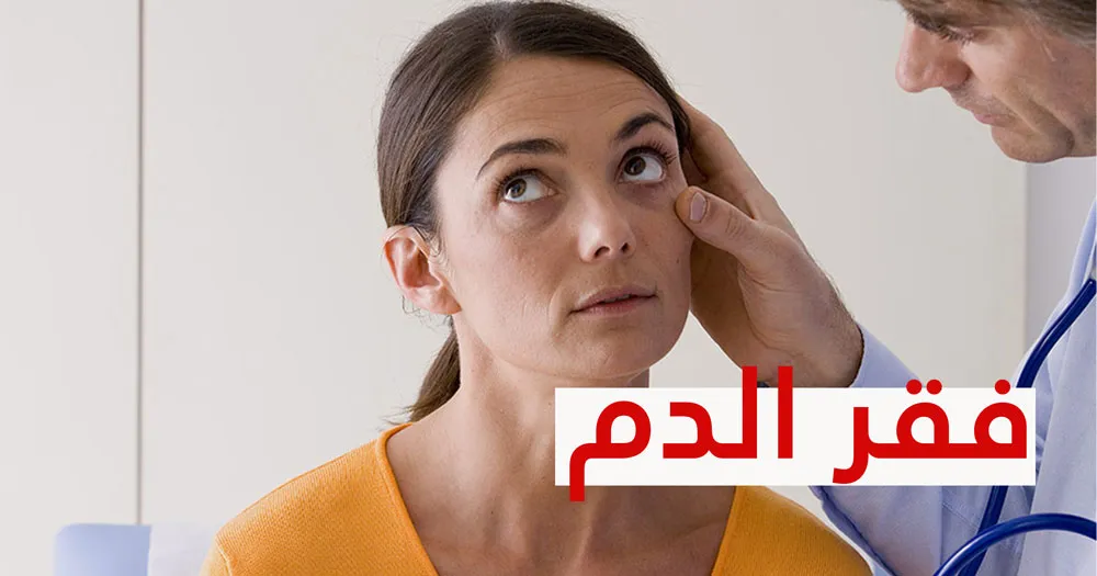اعراض فقر الدم